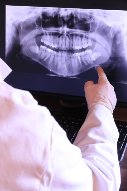Best Weekend Emergency Dentist in Burlington, WA